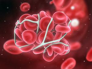 26-1458992513-4-blood-clots